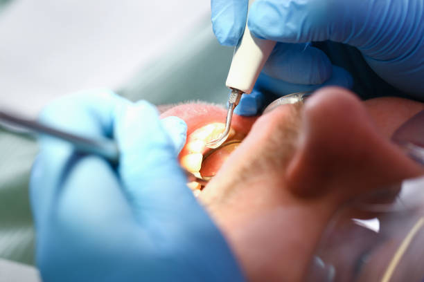 Best Walk-In Emergency Dental Services in Alton, TX