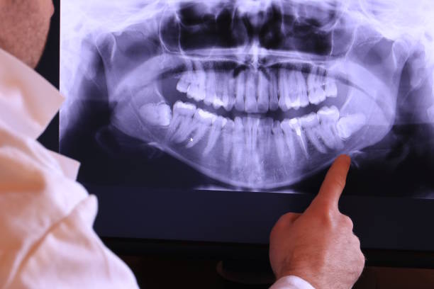 Best Emergency Treatment for Oral Infections in Alton, TX